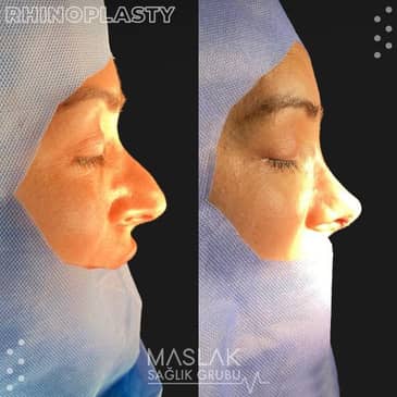 Slider image (2) Maslak Surgical Center